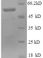 Human Tubulin beta-3 chain (TUBB3), partial Recombinant Protein - BioCrest Sci