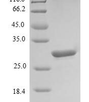 Human Leukocyte cell-derived chemotaxin 1 (LECT1), partial Recombinant Protein - BioCrest Sci