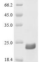 Bos indicus x Bos taurus Alpha-S1-casein, partial Recombinant Protein, C-His, aa 56–126 (A68T,M75T,P102L,111:E→Missing) - BioCrest Sci