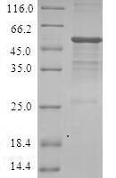 Human GTP-binding protein Di-Ras3 (DIRAS3) Recombinant Protein - BioCrest Sci