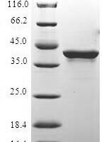 Human Histone H2A.x (H2AFX) Recombinant Protein - BioCrest Sci