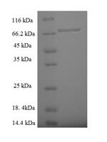 Human Zinc finger protein 212 (ZNF212) Recombinant Protein - BioCrest Sci