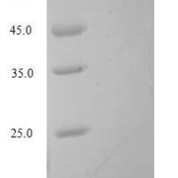Human Oxytocin-neurophysin 1 (OXT) Recombinant Protein, Tag-Free - BioCrest Sci
