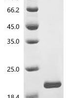 Bordetella pertussis Pertactin autotransporter (prn), partial Recombinant Protein, C-His, aa 41–142 - BioCrest Sci