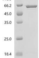 Mycoplasma genitalium Uncharacterized protein MG281 (MG281), partial Recombinant Protein, C-His, aa 37–556 - BioCrest Sci