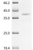 Mouse Thyrotropin subunit beta（Tshb), partial Recombinant Protein - BioCrest Sci