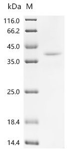 Mouse Thyrotropin subunit beta(Tshb), partial Recombinant Protein, Mus musculus (Mouse), Mammalian cell, C-terminal hFc1-tagged, 39.0 kDa, purity >≥ 95% as determined by SDS-PAGE.