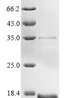 Human cytomegalovirus Envelope glycoprotein B (gB), partial Recombinant Protein - BioCrest Sci