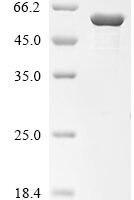 Human Desmin (DES) Recombinant Protein, N-10His - BioCrest Sci