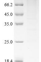 Human Disks large-associated protein 5 (DLGAP5) Recombinant Protein - BioCrest Sci