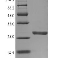 Human Neutrophil elastase (ELANE) Recombinant Protein, N-His - BioCrest Sci