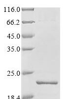 Streptococcus agalactiae serotype III Holo-[acyl-carrier-protein] synthase (acpS) Recombinant Protein - BioCrest Sci