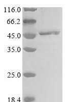 Solanum melongena Anthocyanidin 3-O-glucosyltransferase (GT) Recombinant Protein - BioCrest Sci