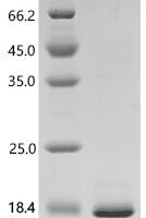 Human Amelogenin, Y isoform (AMELY), partial Recombinant Protein - BioCrest Sci