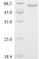 Human Tyrosine-protein kinase JAK2 (JAK2), partial Recombinant Protein, C-His - BioCrest Sci