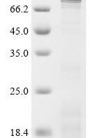 Human cGMP-specific 3',5'-cyclic phosphodiesterase (PDE5A) , partial Recombinant Protein - BioCrest Sci