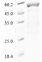 Human Syntenin-1 (SDCBP), partial Recombinant Protein - BioCrest Sci