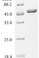 Stenotrophomonas maltophilia Thiolase Recombinant Protein - BioCrest Sci