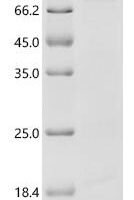 Candida albicans Exocyst subunit (SEC10) Recombinant Protein - BioCrest Sci