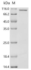 Candida albicans Exocyst subunit (SEC10) Recombinant Protein, Candida albicans (strain SC5314 / ATCC MYA-2876) (Yeast), E.coli, C-terminal 6xHis-tagged, 97.5 kDa, purity >≥ 85% as determined by SDS-PAGE.