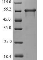 Human WD repeat domain phosphoinositide-interacting protein 4 (WDR45) Recombinant Protein - BioCrest Sci