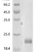 Human Tumor necrosis factor receptor superfamily member 10D (TNFRSF10D), partial Recombinant Protein, N-His - BioCrest Sci