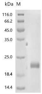 Human Tumor necrosis factor receptor superfamily member 10D (TNFRSF10D), partial Recombinant Protein, N-His, Homo sapiens (Human), E.coli, N-terminal 6xHis-tagged, 20.9 kDa, purity >≥ 90% as determined by SDS-PAGE.