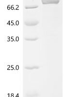 Human TNF receptor-associated factor 3 (TRAF3) Recombinant Protein, N-10His - BioCrest Sci