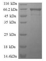 Human Fructose-bisphosphate aldolase A (ALDOA) Recombinant Protein, N-GST - BioCrest Sci