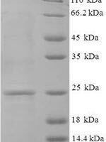 Human Guanylate cyclase activator 2B (GUCA2B) Recombinant Protein, N-His-SUMO - BioCrest Sci