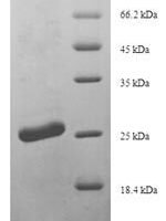 Mouse Scrapie-responsive protein 1 (Scrg1) Recombinant Protein, N-His-SUMO - BioCrest Sci