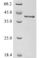 Human Annexin A1 (ANXA1) Recombinant Protein, N-10His - BioCrest Sci