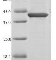 Human Chromodomain-helicase-DNA-binding protein 1-like (CHD1L), partial Recombinant Protein - BioCrest Sci