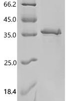 Reston ebolavirus Pre-small/secreted glycoprotein (GP), partial Recombinant Protein, N-His, aa 34–325, E.coli - BioCrest Sci