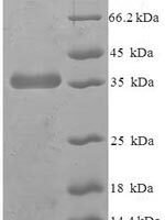 Human Protein-tyrosine phosphatase mitochondrial 1 (PTPMT1) Recombinant Protein - BioCrest Sci