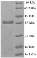 Human Protein-tyrosine phosphatase mitochondrial 1 (PTPMT1) Recombinant Protein, Homo sapiens (Human), E.coli, N-terminal 6xHis-SUMO-tagged, 35.9 kDa, purity >≥ 90% as determined by SDS-PAGE.