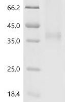 Mouse Interleukin-34（Il34) Recombinant Protein - BioCrest Sci