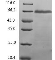 Human Dehydrodolichyl diphosphate synthase (DHDDS) Recombinant Protein - BioCrest Sci