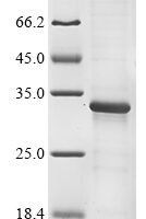 Porcine circovirus 2 Capsid protein (Cap) Recombinant Protein, N-His - BioCrest Sci