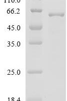 Mouse Aldehyde dehydrogenase 1A1 (Aldh1a1)(171-178:FPMLMFIW→Missing) Recombinant Protein - BioCrest Sci