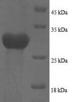 Human Plexin-A1 (PLXNA1), partial Recombinant Protein, N-His, aa 32–296 - BioCrest Sci
