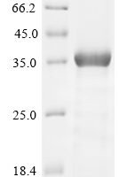 Human Ubiquitin carboxyl-terminal hydrolase 6 (USP6), partial Recombinant Protein - BioCrest Sci