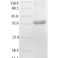 Mouse Renin-2 (Ren2), partial Recombinant Protein - BioCrest Sci