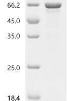 Human Prostaglandin G/H synthase 1 (PTGS1) Recombinant Protein, N-10His/C-Myc - BioCrest Sci