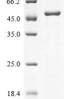 Human Plexin-B2 (PLXNB2), partial Recombinant Protein - BioCrest Sci