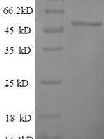 Human 60S ribosomal protein L15 (RPL15) Recombinant Protein - BioCrest Sci