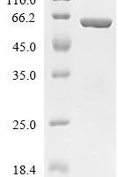 Human Caspase-1 (CASP1), partial, Biotinylated Recombinant Protein - BioCrest Sci