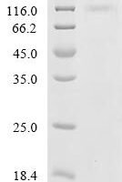 Lassa virus Pre-glycoprotein polyprotein GP complex (GPC), partial Recombinant Protein, N-10His - BioCrest Sci