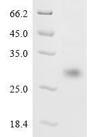Severe acute respiratory syndrome coronavirus 2 Spike glycoprotein (S), partial Recombinant Protein, C-His - BioCrest Sci