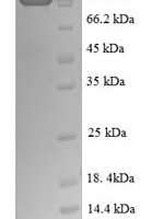 Human Nuclear factor NF-kappa-B p105 subunit (NFKB1) Recombinant Protein, N-GST - BioCrest Sci